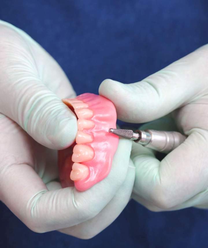 Boisbriand denture relining