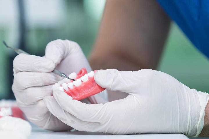 Pose de coussinets adhésifs sur prothèse dentaire inférieure