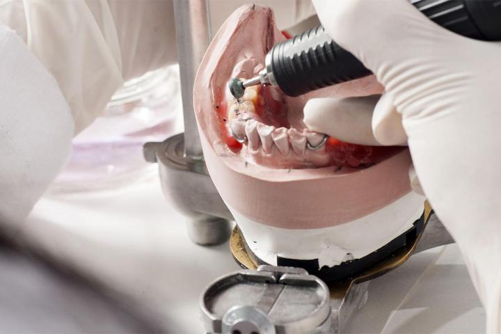 Lower denture cushioning Boisbriand