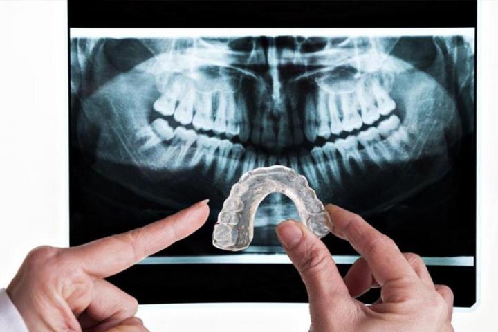 Denture repair and manufacture Boisbriand