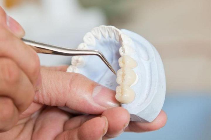 Adhesive pads for lower denture Boisbriand