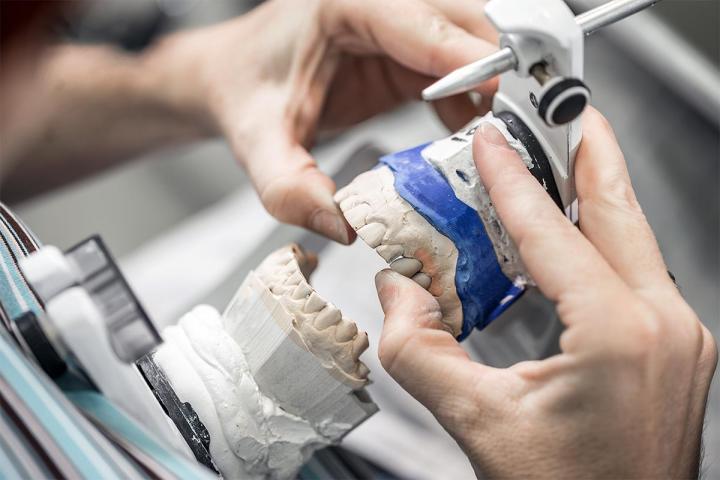 Placement of cushion on lower denture Boisbriand